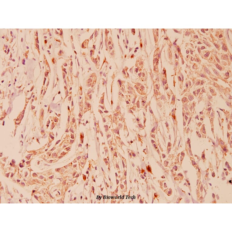 Anti-FGFR1 OP (N371) Antibody from Bioworld Technology (BS1123) - Antibodies.com