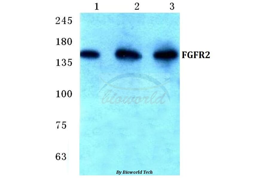 Anti-FGFR2 (V501) Antibody from Bioworld Technology (BS1124) - Antibodies.com