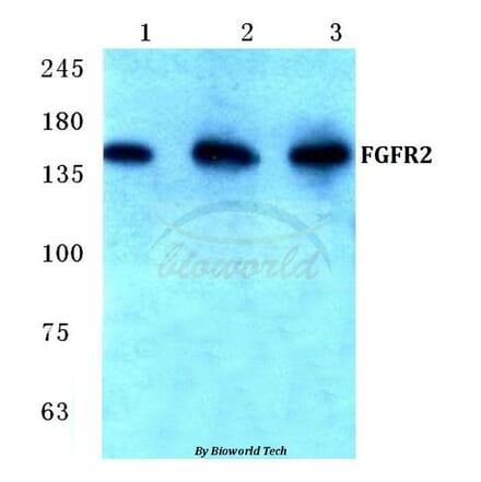 Anti-FGFR2 (V501) Antibody from Bioworld Technology (BS1124) - Antibodies.com