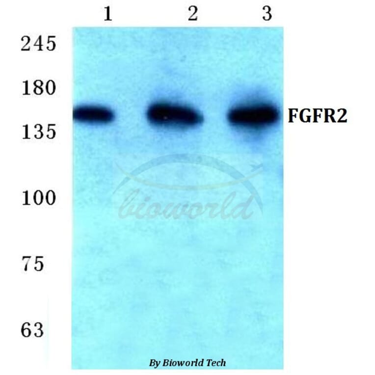 Anti-FGFR2 (V501) Antibody from Bioworld Technology (BS1124) - Antibodies.com