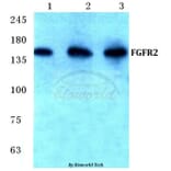 Anti-FGFR2 (V501) Antibody from Bioworld Technology (BS1124) - Antibodies.com