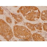 Anti-FGFR2 (V501) Antibody from Bioworld Technology (BS1124) - Antibodies.com