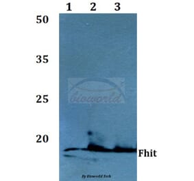 Anti-FHIT (E116) Antibody from Bioworld Technology (BS1126) - Antibodies.com