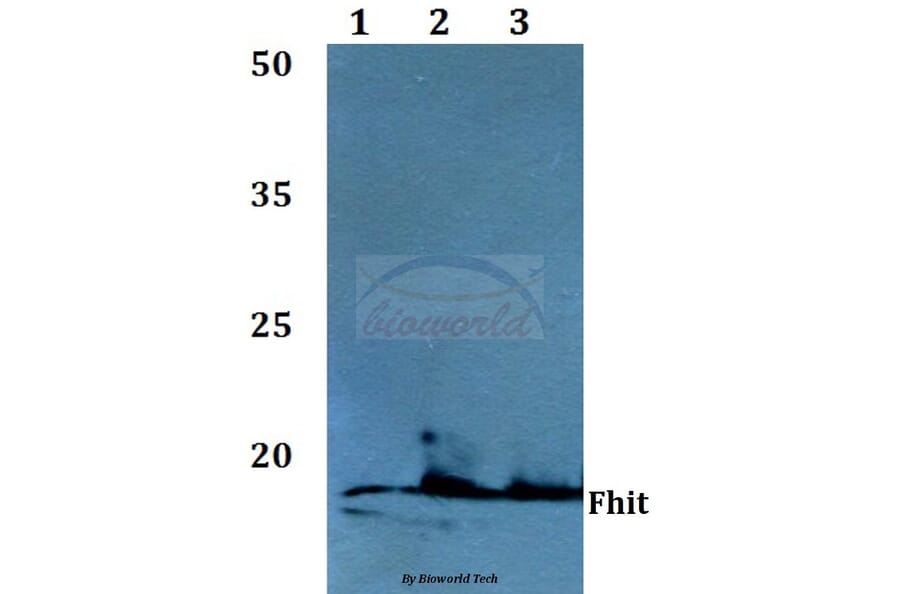 Anti-FHIT (E116) Antibody from Bioworld Technology (BS1126) - Antibodies.com