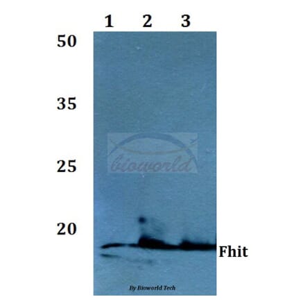 Anti-FHIT (E116) Antibody from Bioworld Technology (BS1126) - Antibodies.com
