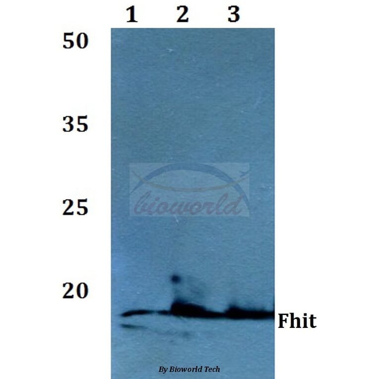 Anti-FHIT (E116) Antibody from Bioworld Technology (BS1126) - Antibodies.com