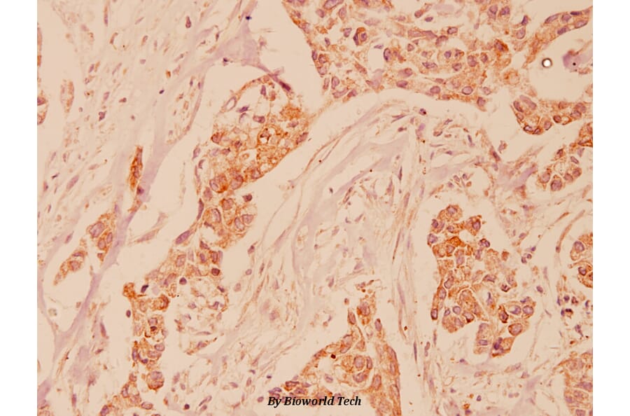 Anti-FHIT (E116) Antibody from Bioworld Technology (BS1126) - Antibodies.com