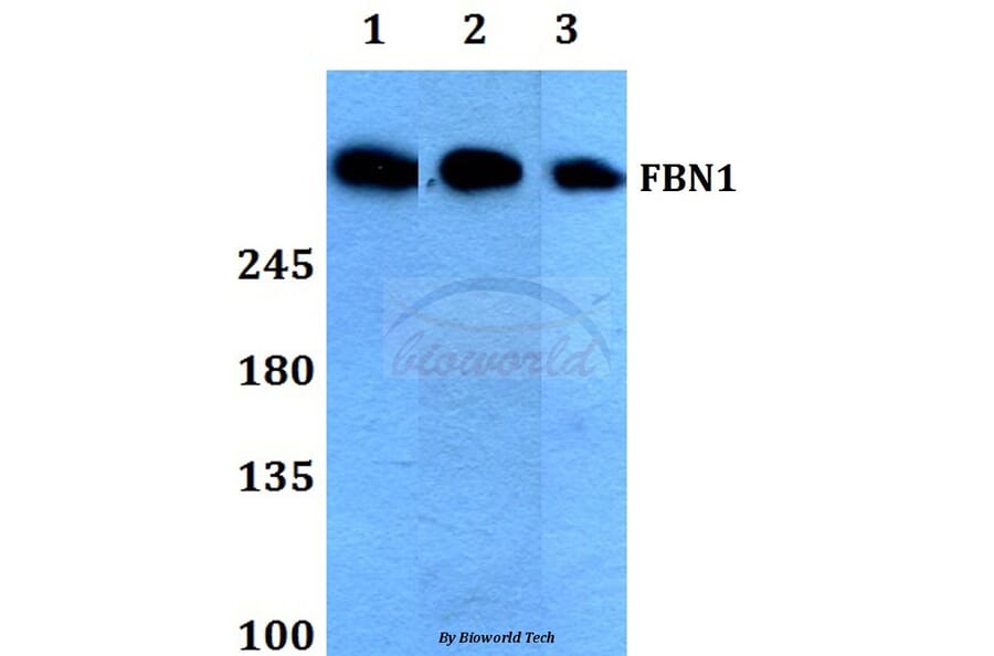 Anti-FBN1 (N2843) Antibody from Bioworld Technology (BS1127) - Antibodies.com