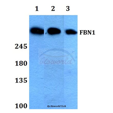 Anti-FBN1 (N2843) Antibody from Bioworld Technology (BS1127) - Antibodies.com