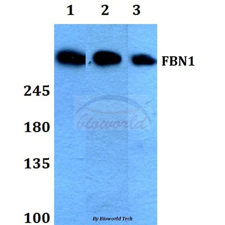 Anti-FBN1 (N2843) Antibody from Bioworld Technology (BS1127) - Antibodies.com