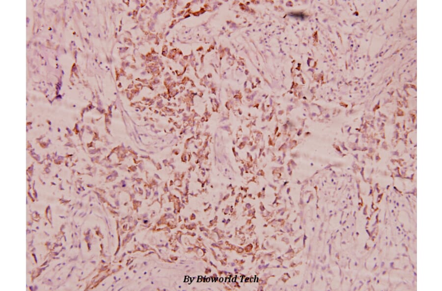 Anti-FBN1 (N2843) Antibody from Bioworld Technology (BS1127) - Antibodies.com