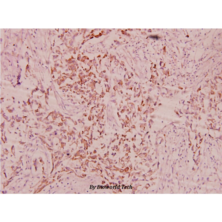 Anti-FBN1 (N2843) Antibody from Bioworld Technology (BS1127) - Antibodies.com