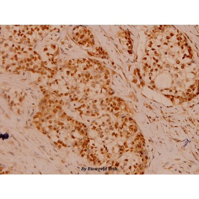 Anti-Filamin 1 (R2146) Antibody from Bioworld Technology (BS1128) - Antibodies.com