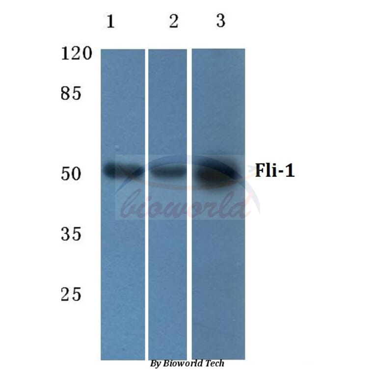Anti-Fli-1 (R319) Antibody from Bioworld Technology (BS1129) - Antibodies.com