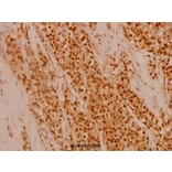 Anti-Fli-1 (R319) Antibody from Bioworld Technology (BS1129) - Antibodies.com
