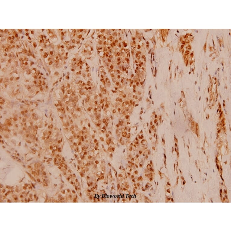 Anti-c-Fos (F3) Antibody from Bioworld Technology (BS1130) - Antibodies.com