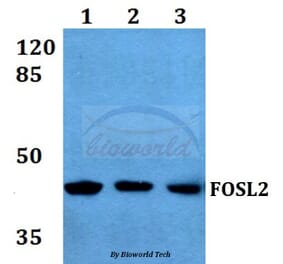 Anti-FOSL2 (S301) Antibody from Bioworld Technology (BS1131) - Antibodies.com