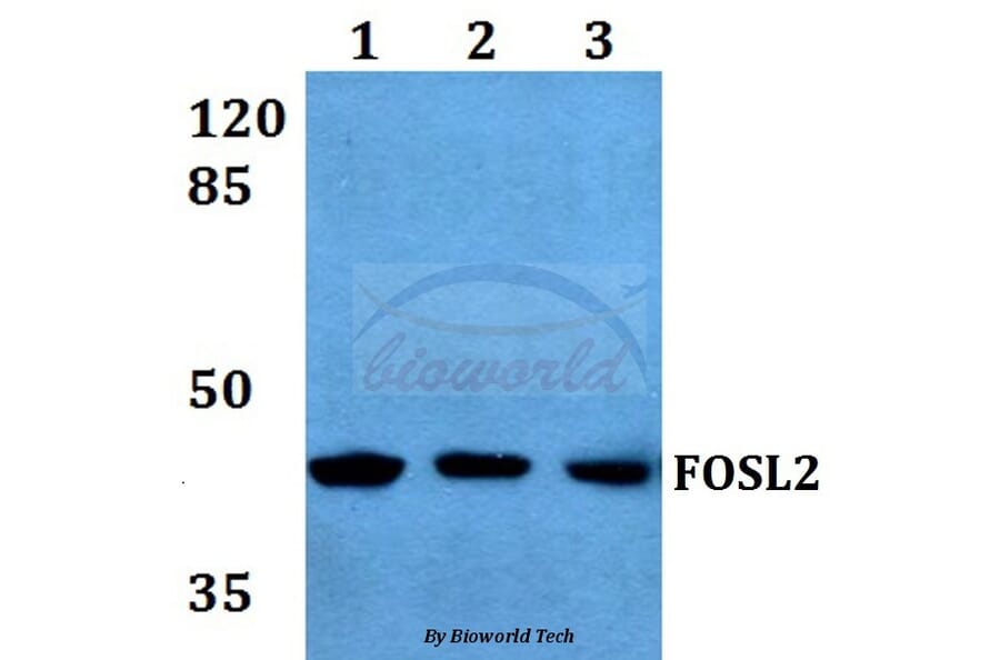 Anti-FOSL2 (S301) Antibody from Bioworld Technology (BS1131) - Antibodies.com