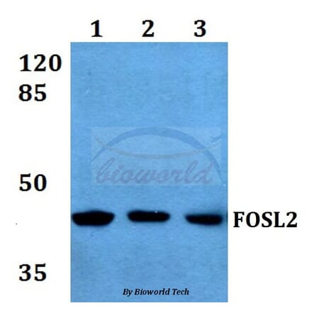 Anti-FOSL2 (S301) Antibody from Bioworld Technology (BS1131) - Antibodies.com