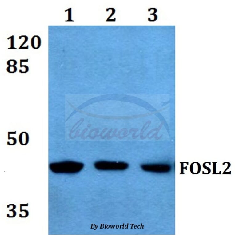 Anti-FOSL2 (S301) Antibody from Bioworld Technology (BS1131) - Antibodies.com