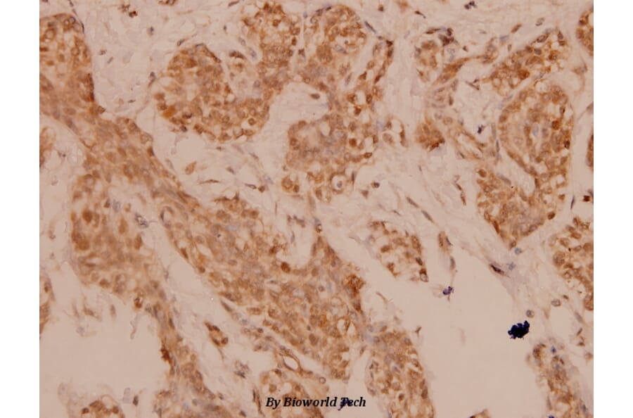 Anti-FOSL2 (S301) Antibody from Bioworld Technology (BS1131) - Antibodies.com