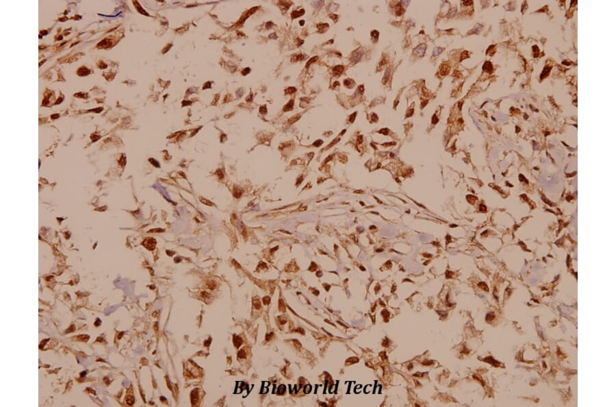 Anti-GABAB R1 (I902) Antibody from Bioworld Technology (BS1133) - Antibodies.com