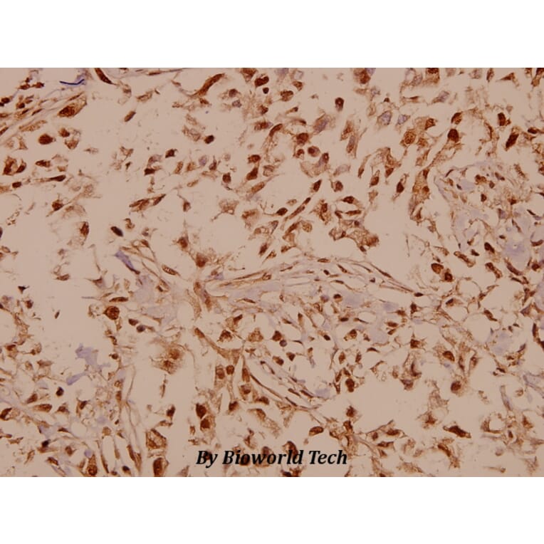 Anti-GABAB R1 (I902) Antibody from Bioworld Technology (BS1133) - Antibodies.com