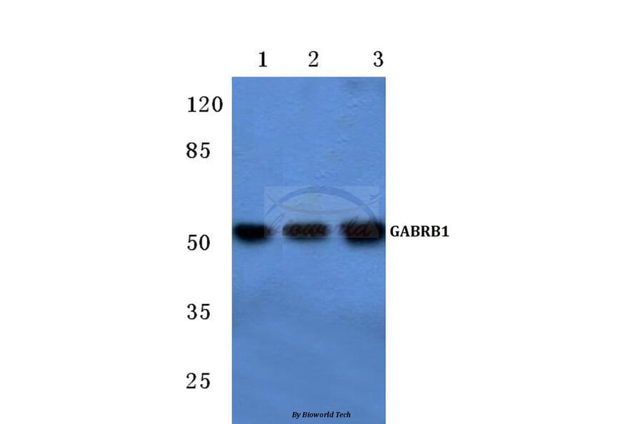 Anti-GABAA Rβ1 (R328) Antibody from Bioworld Technology (BS1134) - Antibodies.com