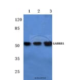 Anti-GABAA Rβ1 (R328) Antibody from Bioworld Technology (BS1134) - Antibodies.com