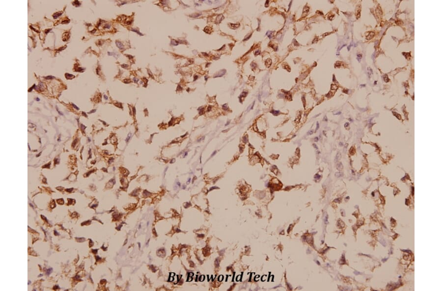 Anti-GABAA Rβ1 (R328) Antibody from Bioworld Technology (BS1134) - Antibodies.com