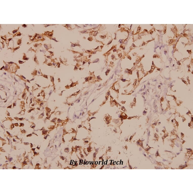 Anti-GABAA Rβ1 (R328) Antibody from Bioworld Technology (BS1134) - Antibodies.com