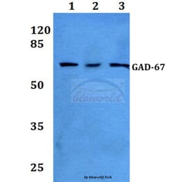 Anti-GAD-67 (A492) Antibody from Bioworld Technology (BS1135) - Antibodies.com