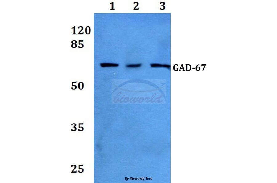Anti-GAD-67 (A492) Antibody from Bioworld Technology (BS1135) - Antibodies.com
