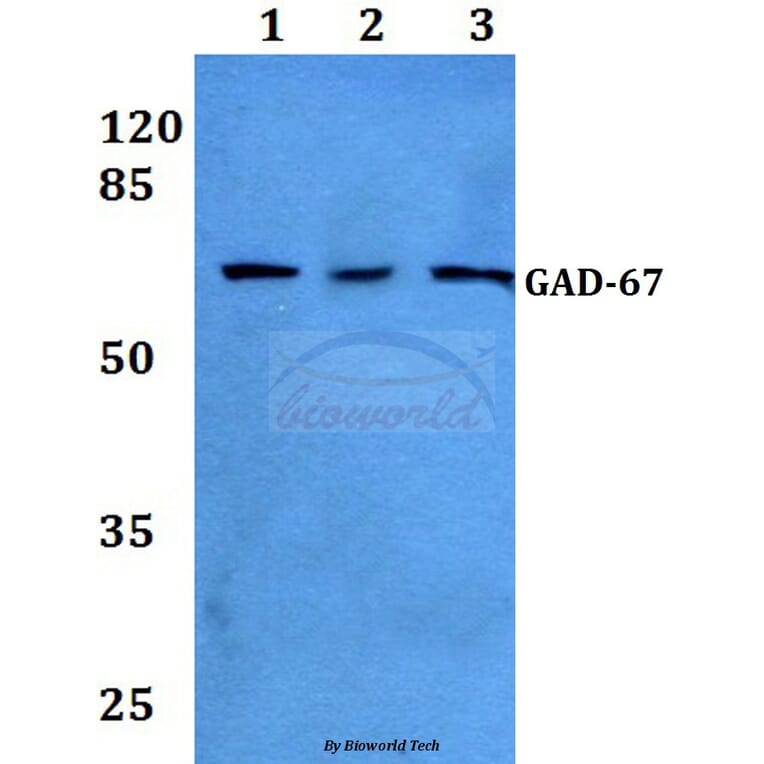 Anti-GAD-67 (A492) Antibody from Bioworld Technology (BS1135) - Antibodies.com