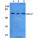 Anti-GAD-67 (A492) Antibody from Bioworld Technology (BS1135) - Antibodies.com