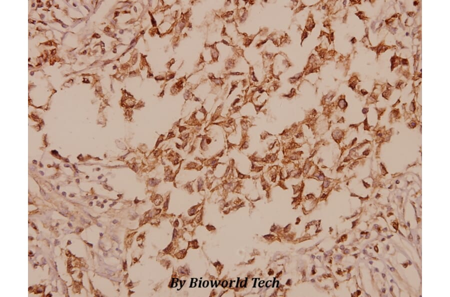 Anti-GAD-67 (A492) Antibody from Bioworld Technology (BS1135) - Antibodies.com