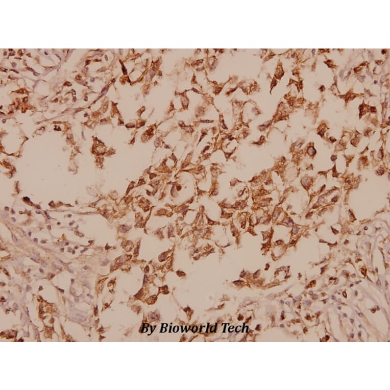 Anti-GAD-67 (A492) Antibody from Bioworld Technology (BS1135) - Antibodies.com