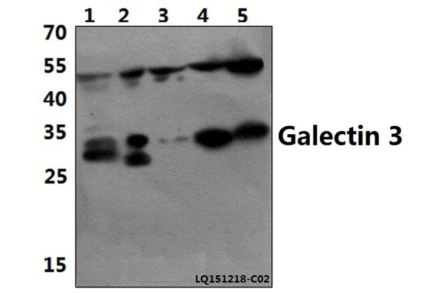Anti-Galectin-3 (N174) Antibody from Bioworld Technology (BS1137) - Antibodies.com