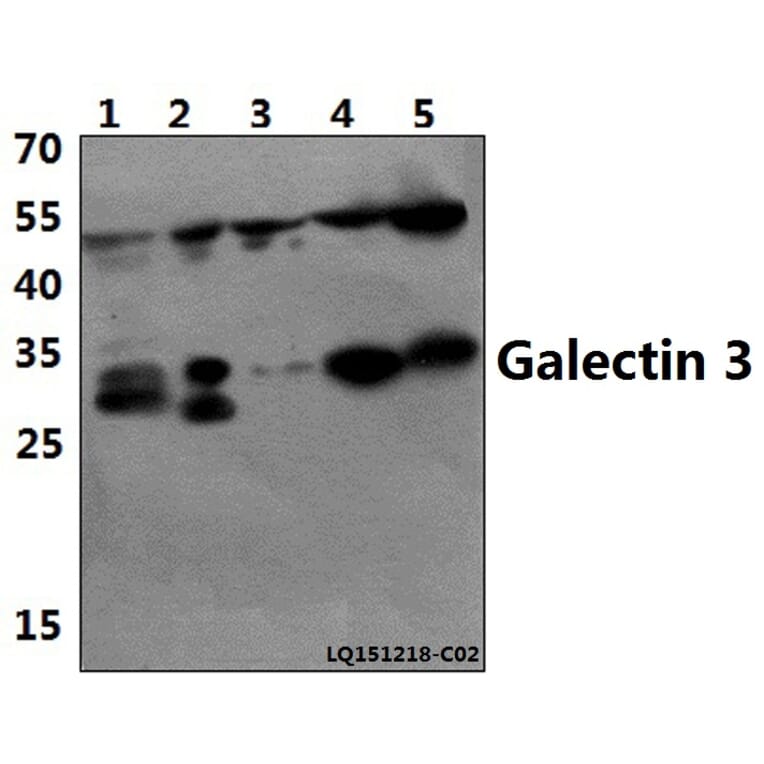 Anti-Galectin-3 (N174) Antibody from Bioworld Technology (BS1137) - Antibodies.com