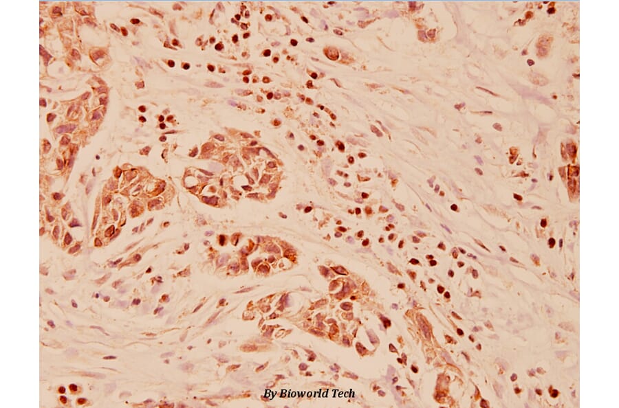 Anti-Galectin-3 (N174) Antibody from Bioworld Technology (BS1137) - Antibodies.com