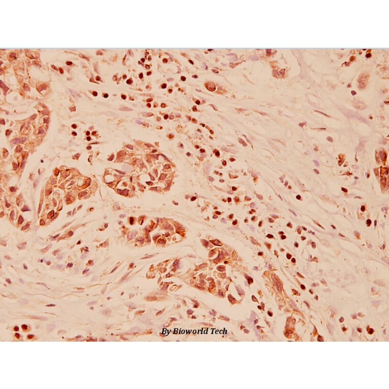 Anti-Galectin-3 (N174) Antibody from Bioworld Technology (BS1137) - Antibodies.com