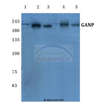 Anti-GANP (E1872) Antibody from Bioworld Technology (BS1138) - Antibodies.com