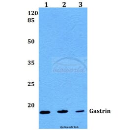 Anti-Gastrin (M90) Antibody from Bioworld Technology (BS1139) - Antibodies.com