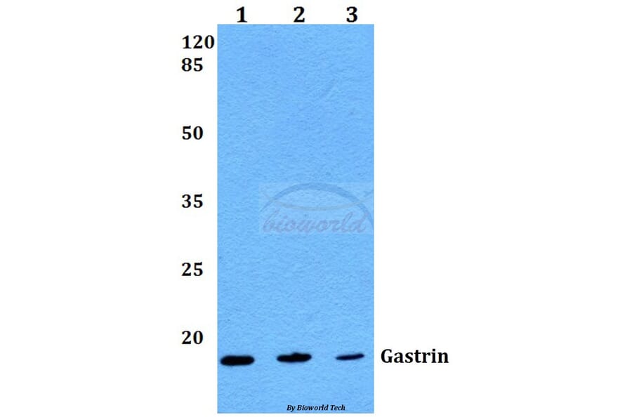 Anti-Gastrin (M90) Antibody from Bioworld Technology (BS1139) - Antibodies.com
