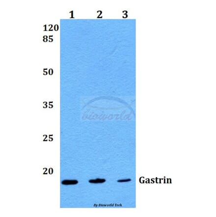 Anti-Gastrin (M90) Antibody from Bioworld Technology (BS1139) - Antibodies.com