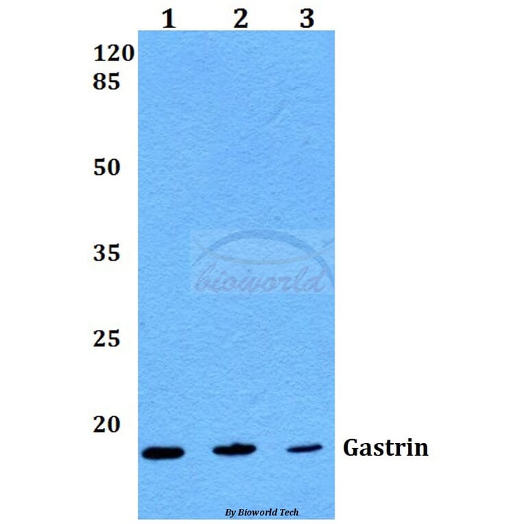 Anti-Gastrin (M90) Antibody from Bioworld Technology (BS1139) - Antibodies.com