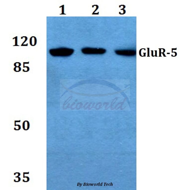 Anti-GluR-5 (L12) Antibody from Bioworld Technology (BS1145) - Antibodies.com