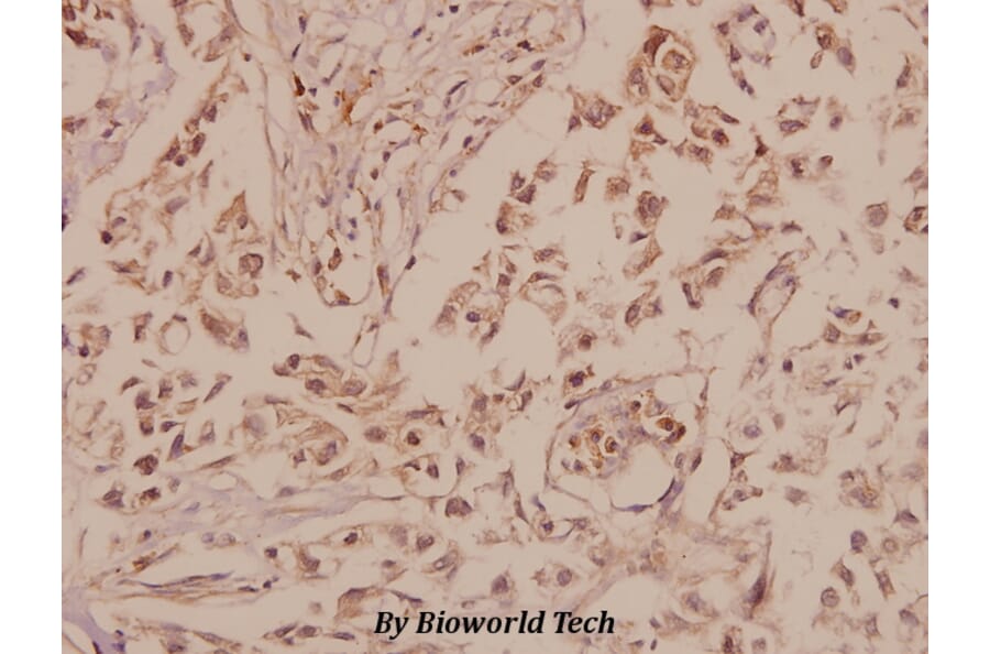 Anti-GluR-5 (L12) Antibody from Bioworld Technology (BS1145) - Antibodies.com