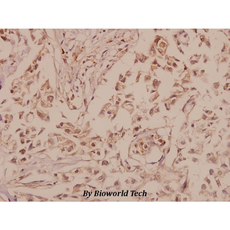 Anti-GluR-5 (L12) Antibody from Bioworld Technology (BS1145) - Antibodies.com