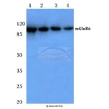 Anti-mGluR-6 (A865) Antibody from Bioworld Technology (BS1146) - Antibodies.com